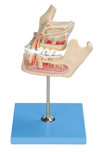 Патологическая людская модель зубов/модель челюсти с подбором цветов компьютером о 2 частях