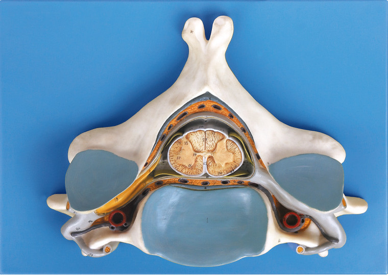 Пятое цервикальное Vertrebra с моделью спинного мозга и нерва анатомической людской каркасной