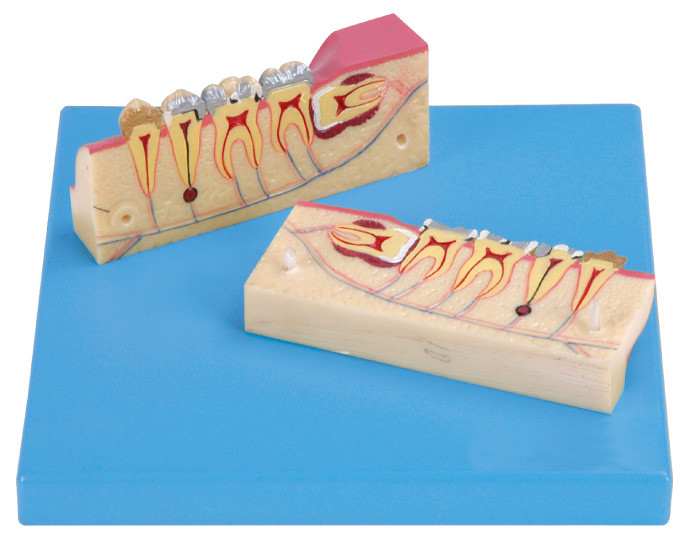 12 положения показаны модели Dissected ткани зубов