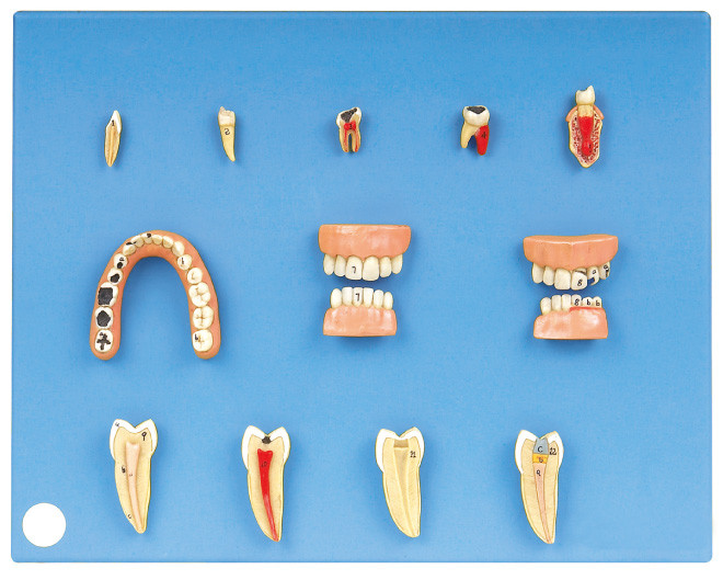 Зубоврачебная модель заболеваниями сделанная из предварительного PVC для интернатуры и тренировки студентов