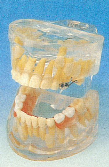 Модель зубов зубоврачебных школ людская/прозрачная модель развития зубов молока
