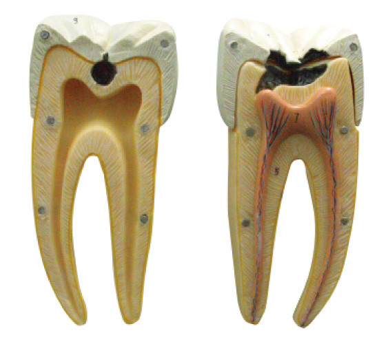 В инициале и предварительных этапах модели зубоврачебной костоеды для учить и тренировки
