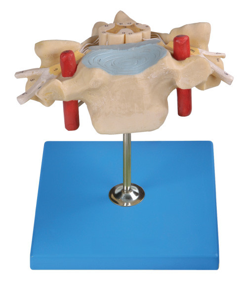 Цервикальное Vertrebra с моделью анатомирования спинного мозга людской показывает хребтовую артерию, вену, нерв
