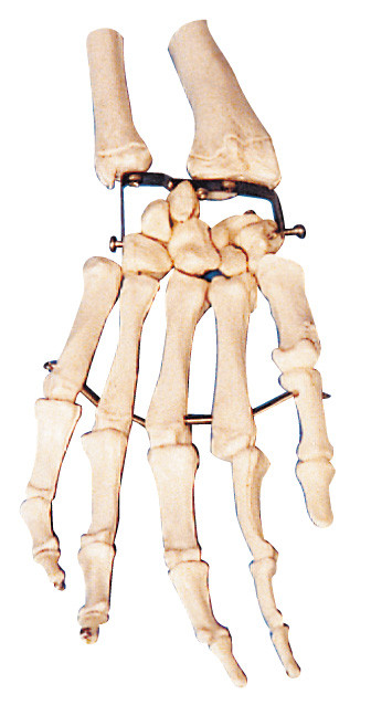 Модель тренировки модели анатомирования косточки ладони людская для медицинского института