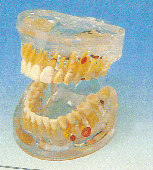 Модель зубов взрослой прозрачной зубоврачебной патологии людская для тренировки коллежей