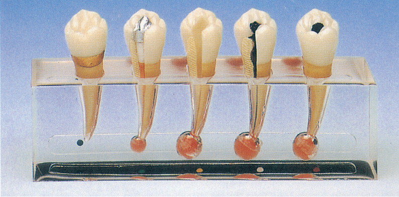 Клиническая модель патологии Endodontics включает 5 частей для тренировки клиники