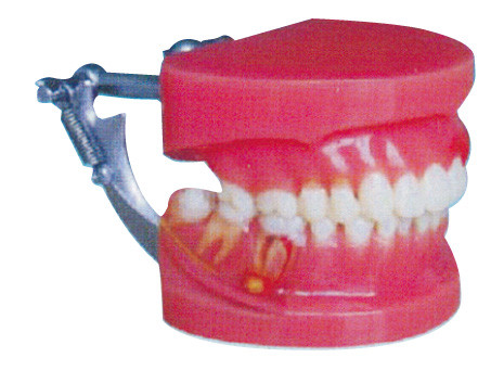 Доктор Дженерала красных и белых зубов демонстрации периодонтальным заболеванием людских модельный