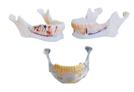 Зубы дантиста моделируют нижнечелюстную модель с нервами, артериями и венами