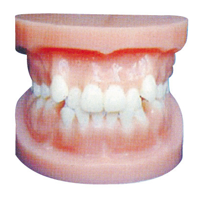 Зубоврачебный implant моделирует/ортодонтическая модель для анатомической тренировки