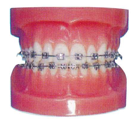 Ортодонтическая людская модель зубов для больниц и зубоврачебной тренировки больницы