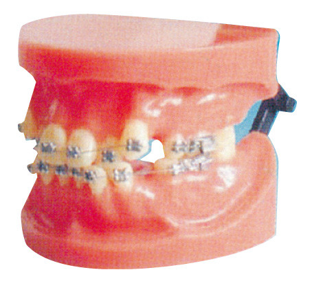 Модель вывихивания фикчированная ортодонтическая для медицинского коллежа и зубоврачебной тренировки больницы